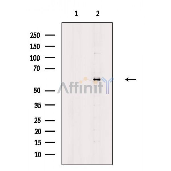 ADCK4 Antibody - Western blot analysis of extracts from HepG2 cells(serum starvation treatment), using ADCK4 Antibody.