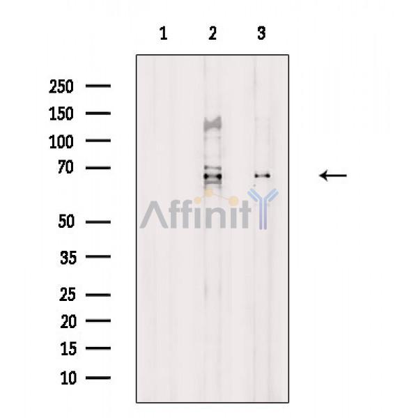 APC8 Antibody - Western blot analysis of extracts from various samples, using APC8 Antibody.