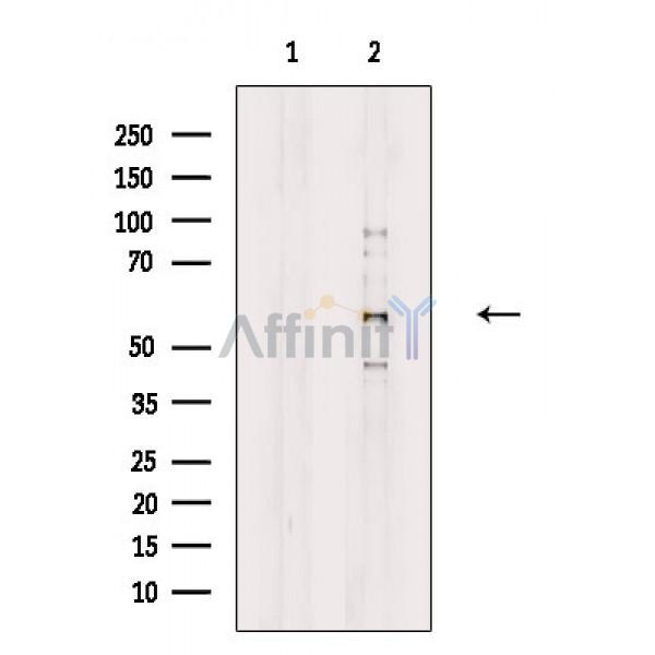 CLK4 Antibody - Western blot analysis of extracts from HepG2 cells(serum starvation treatment), using CLK4 Antibody.
