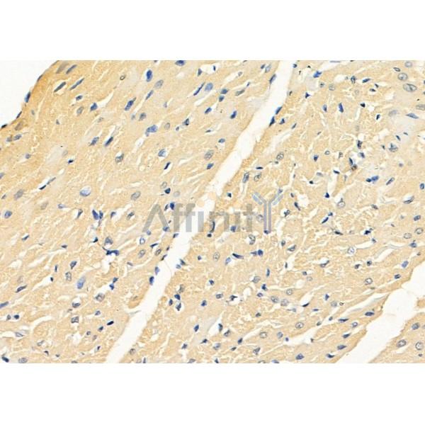 KLHL3 Antibody - DF8672 at 1/100 staining Rat heart tissue by IHC-P.