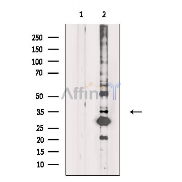 OR5H1 Antibody - Western blot analysis of extracts from Rat heart, using OR5H1 Antibody.