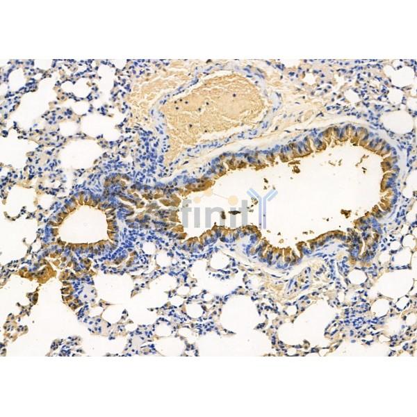 RIOK3 Antibody - DF8715 at 1/100 staining Mouse lung tissue by IHC-P.