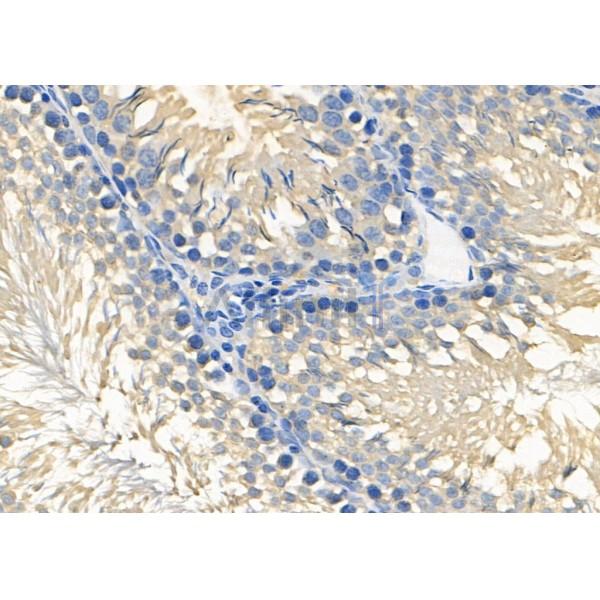 RIOK3 Antibody - DF8715 at 1/100 staining Rat testis tissue by IHC-P.