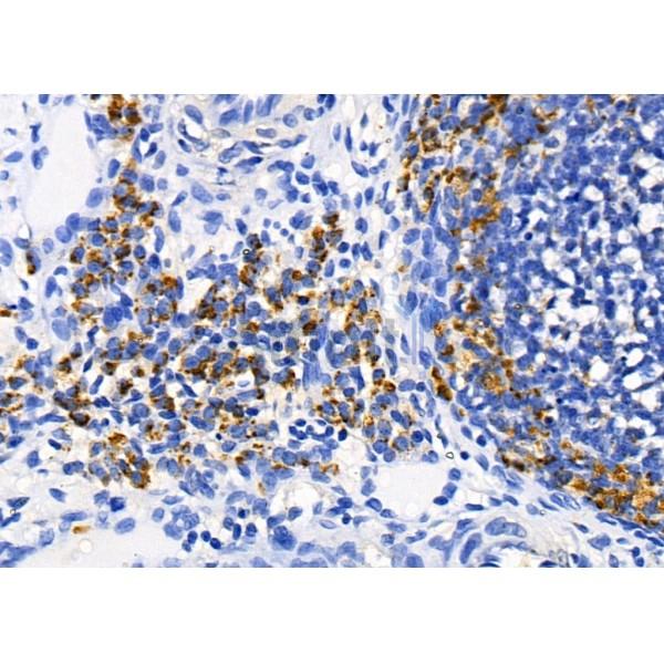 AKAP12 Antibody - DF8813 at 1/100 staining Rat ovarian tissue by IHC-P.
