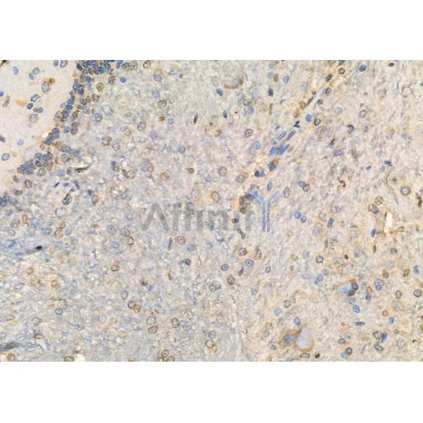 WNK2 Antibody - DF8894 at 1/100 staining Rat brain tissue by IHC-P.