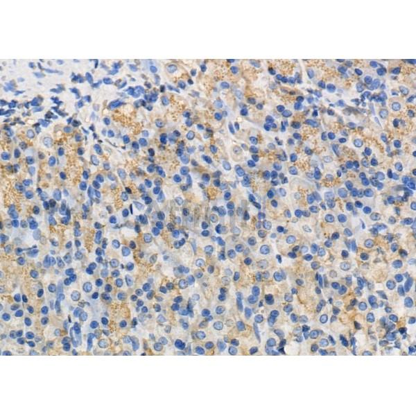WNK2 Antibody - DF8894 at 1/100 staining Rat stomach tissue by IHC-P.