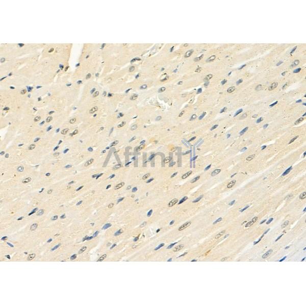 CIDEC Antibody - DF8913 at 1/100 staining Rat heart tissue by IHC-P.