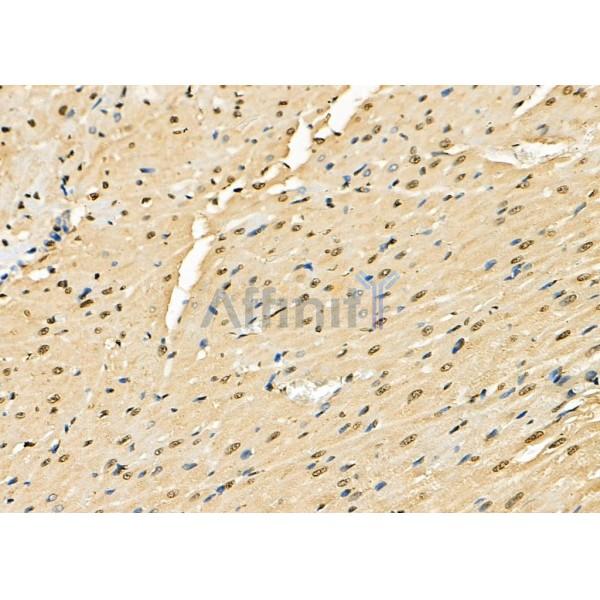 DNAJA1 Antibody - DF8940 at 1/100 staining Rat heart tissue by IHC-P.