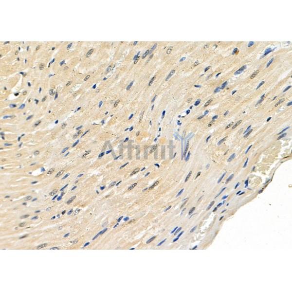 KDM5A Antibody - DF8998 at 1/100 staining Rat heart tissue by IHC-P.