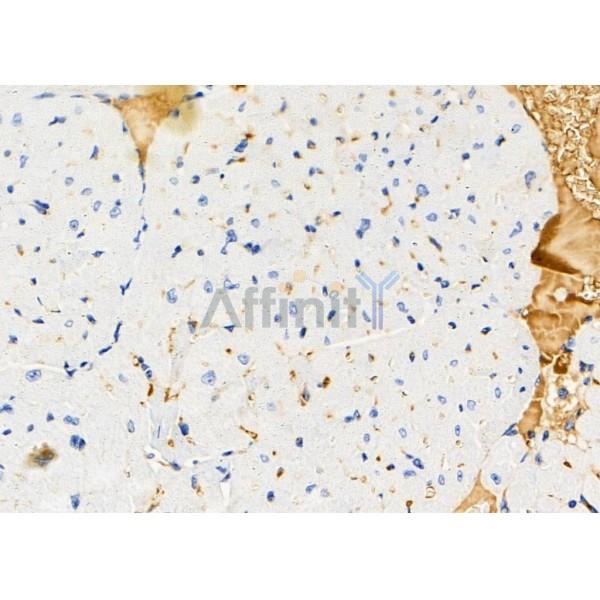 S100A7 Antibody - DF9783 at 1/100 staining Mouse heart tissue by IHC-P.