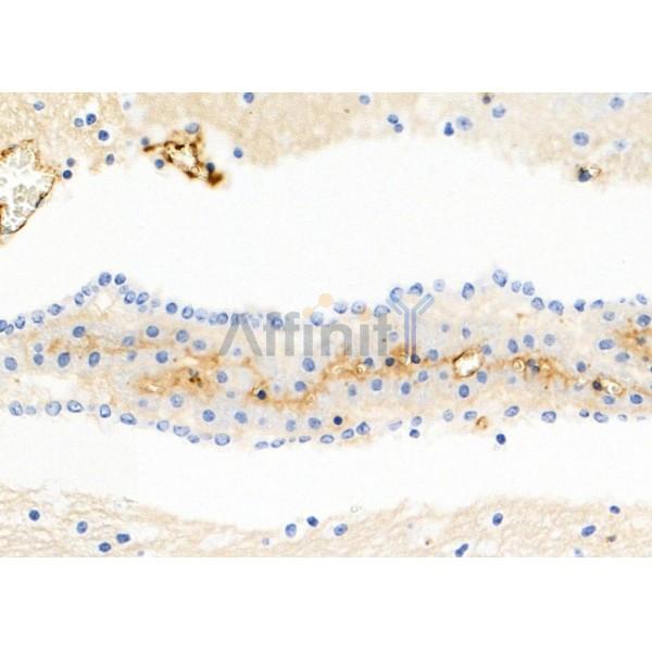 S100A7 Antibody - DF9783 at 1/100 staining Mouse brain tissue by IHC-P.