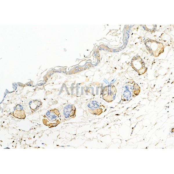 S100A7 Antibody - DF9783 at 1/100 staining Mouse skin tissue by IHC-P.