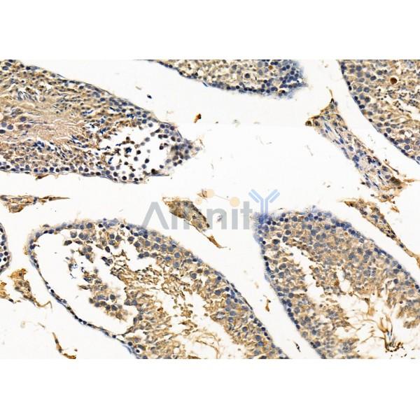 RAB11FIP1 Antibody - DF9795 at 1/100 staining Mouse testis tissue by IHC-P.