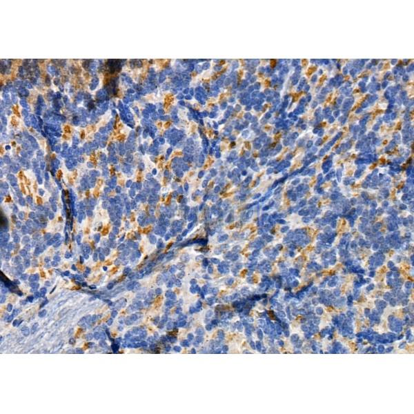 RAB11FIP1 Antibody - DF9795 at 1/100 staining Rat brain tissue by IHC-P.