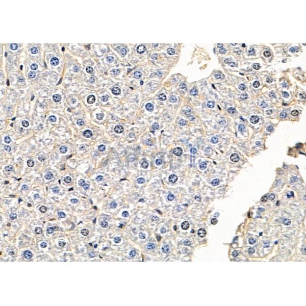 PTPRK Antibody - DF9842 at 1/100 staining Mouse liver tissue by IHC-P.