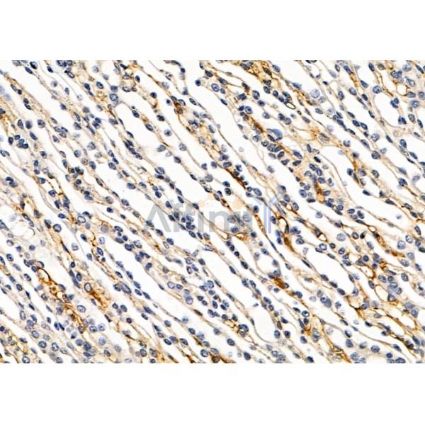 PTPRK Antibody - DF9842 at 1/100 staining Mouse kidney tissue by IHC-P.