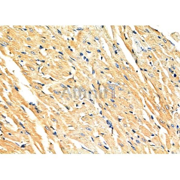 NEK4 Antibody - DF9886 at 1/100 staining Rat heart tissue by IHC-P.
