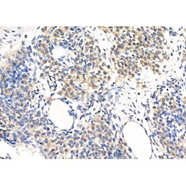 PPP4R1 Antibody - DF9893 at 1/100 staining Rat ovarian tissue by IHC-P.