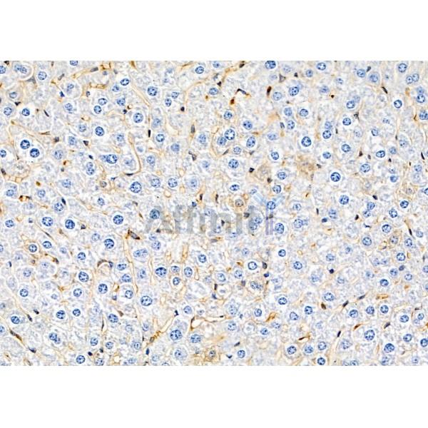 SH2D4A Antibody - DF9897 at 1/100 staining Mouse liver tissue by IHC-P.