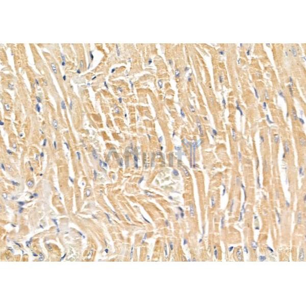 SLC4A7 Antibody - DF9927 at 1/100 staining Rat heart tissue by IHC-P.