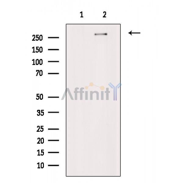 SETD2 Antibody - Western blot analysis of SETD2 in lysates of HeLa , using SETD2 Antibody(AF7552).