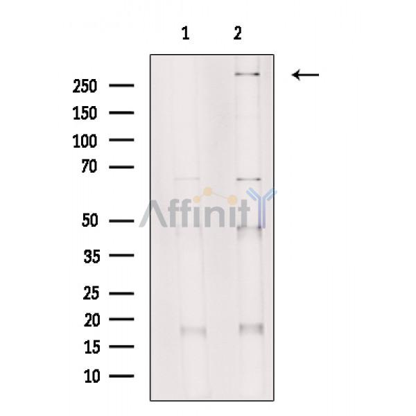 SETD2 Antibody - Western blot analysis of Hela cell lysates, using SETD2 Antibody.