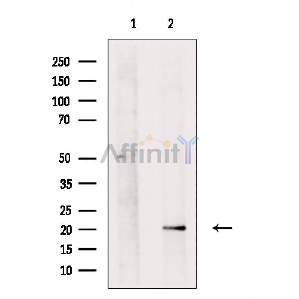 AIF1/IBA1 Antibody - Western blot analysis IBA1 using HeLa whole cell lysates.