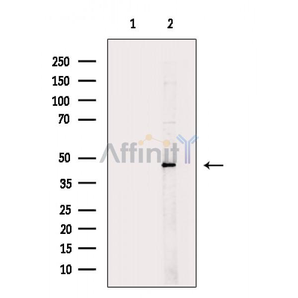 BCKD Antibody - Western blot analysis of extracts from Mouse kidney, using BCKD Antibody.