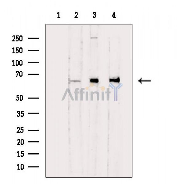 NF-kB p65 Antibody - Western blot analysis of extracts from various samples, using NF-kB p65 Antibody.