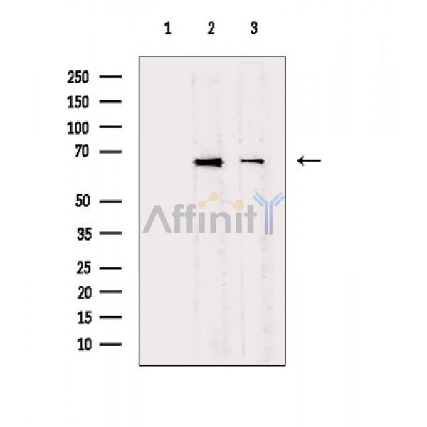 NF-kB p65 Antibody - Western blot analysis of extracts from various samples, using NF-kB p65 Antibody.