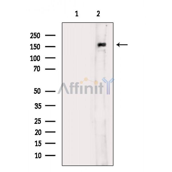c-Met Antibody - Western blot analysis of extracts from Rat kidney, using c-Met Antibody.