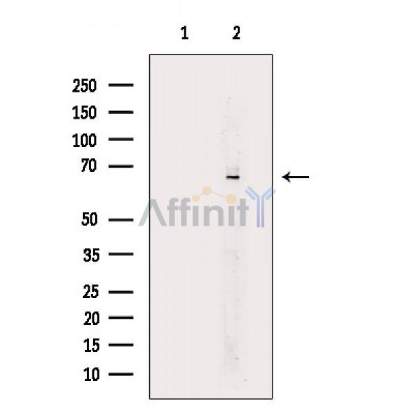 Phospho-CAMKK1/2 (Ser458/Ser495) Antibody - Western blot analysis of extracts from Rat liver, using Phospho-CAMKK1/2 (Ser458/Ser495) Antibody.
