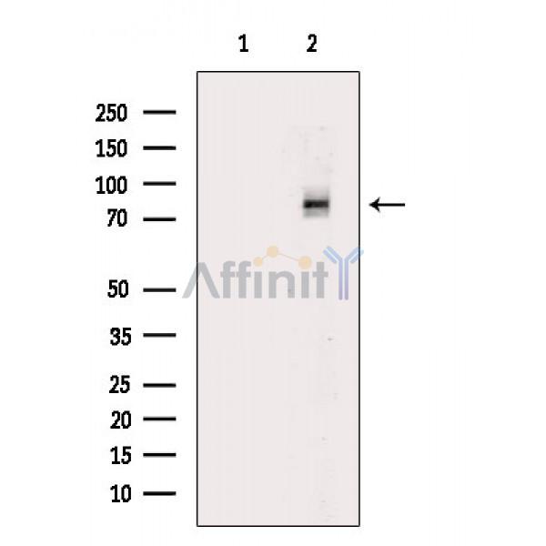 Phospho-DRP1 (Ser616) Antibody - Western blot analysis of extracts from HepG2 cells(H2O2 treatment), using Phospho-DRP1 (Ser616) Antibody.