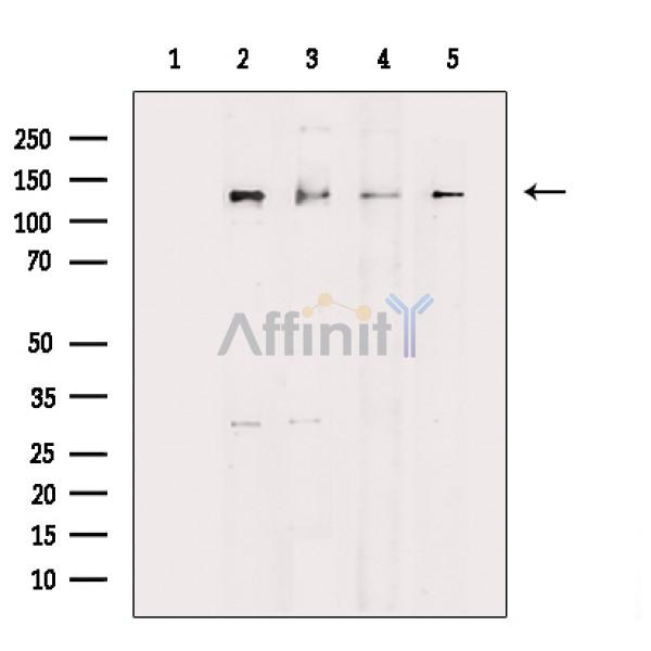 JMY Antibody - Western blot analysis of extracts from various samples, using JMY Antibody.