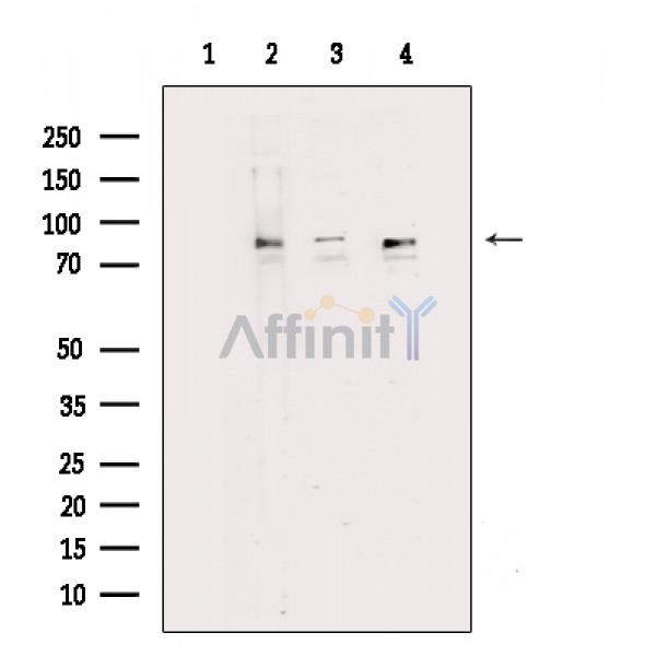 MARK3 Antibody - Western blot analysis of extracts from various samples, using MARK3 Antibody.