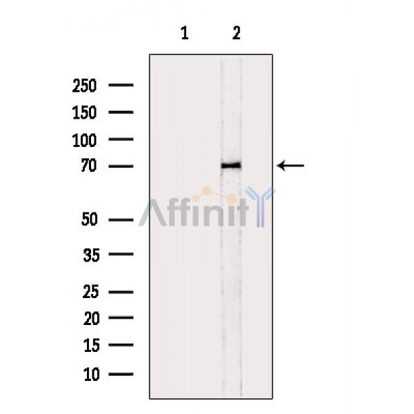 ABCD4 Antibody - Western blot analysis of extracts from Mouse liver, using ABCD4 Antibody.