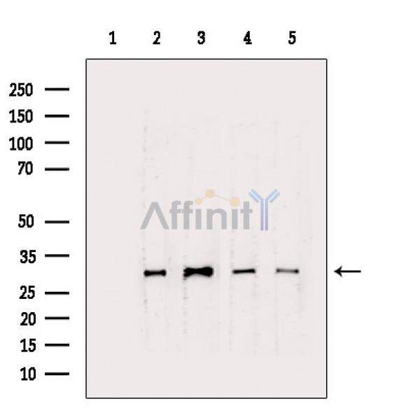CTDSP1 Antibody - Western blot analysis of extracts from various samples, using CTDSP1 Antibody.