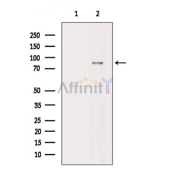 APP Antibody - Western blot analysis of extracts from HepG2 cells(serum starvation treatment), using APP Antibody.
