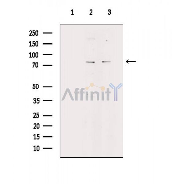PKC alpha Antibody - Western blot analysis of extracts from various samples, using PKC alpha Antibody.