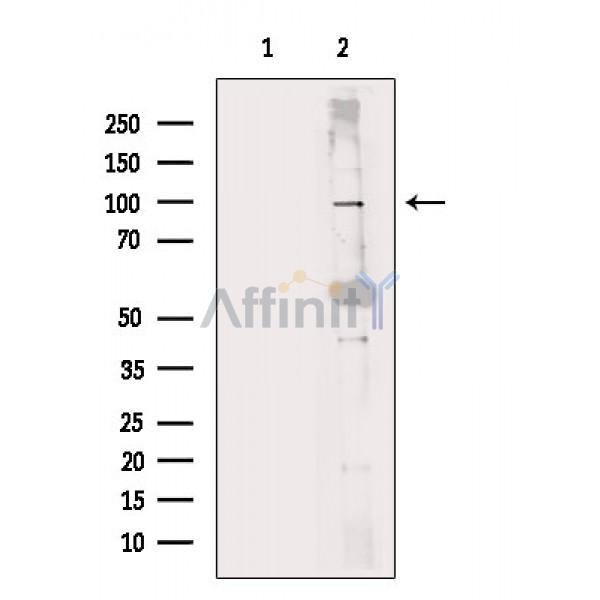 NFAT1 Antibody - Western blot analysis of extracts from A549 cells(heat shock treatment), using NFAT1 Antibody.