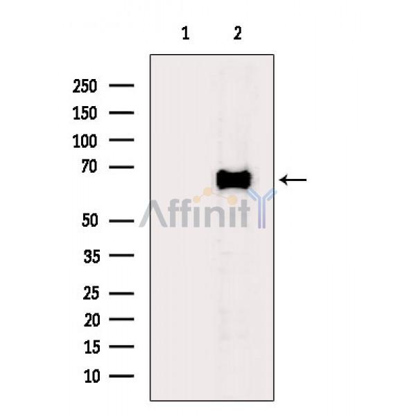 GAD1/2 Antibody - Western blot analysis of extracts from Mouse brain, using GAD1/2 Antibody.