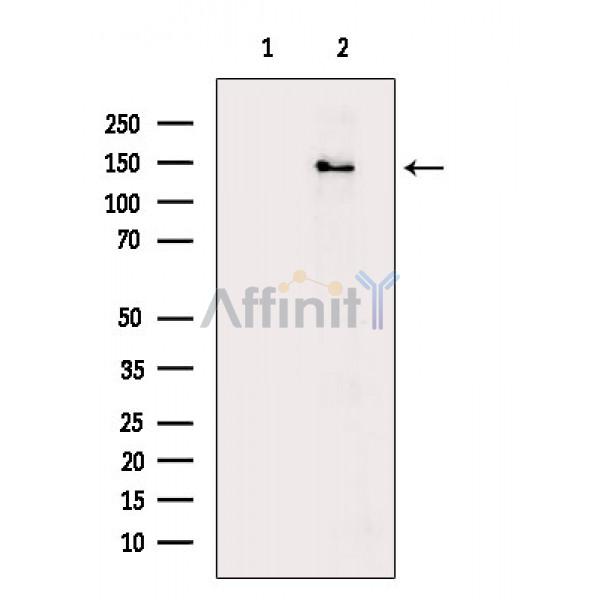c-Kit Antibody - Western blot analysis of extracts from RAW264.