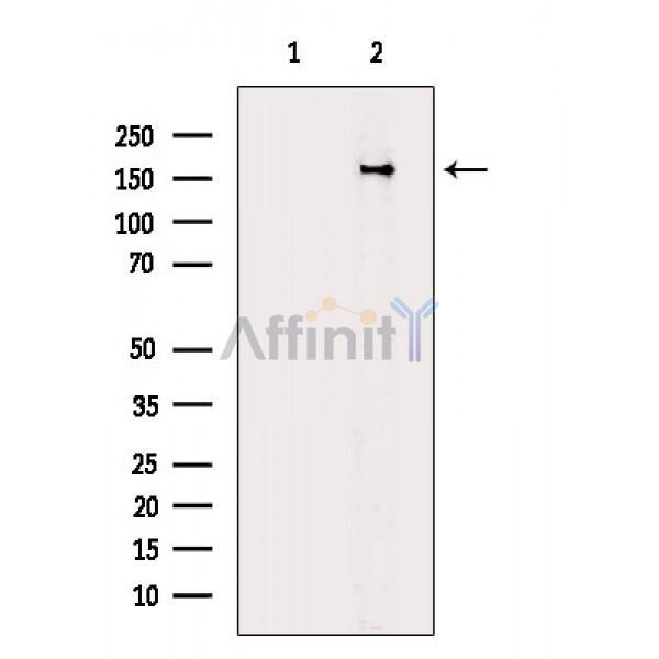 Integrin beta 1 Antibody - Western blot analysis of extracts from HepG2 cells, using Integrin beta 1 Antibody.