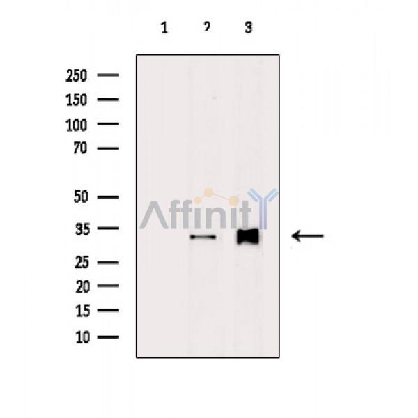 RPS6 Antibody - Western blot analysis of extracts from various samples, using RPS6 Antibody.