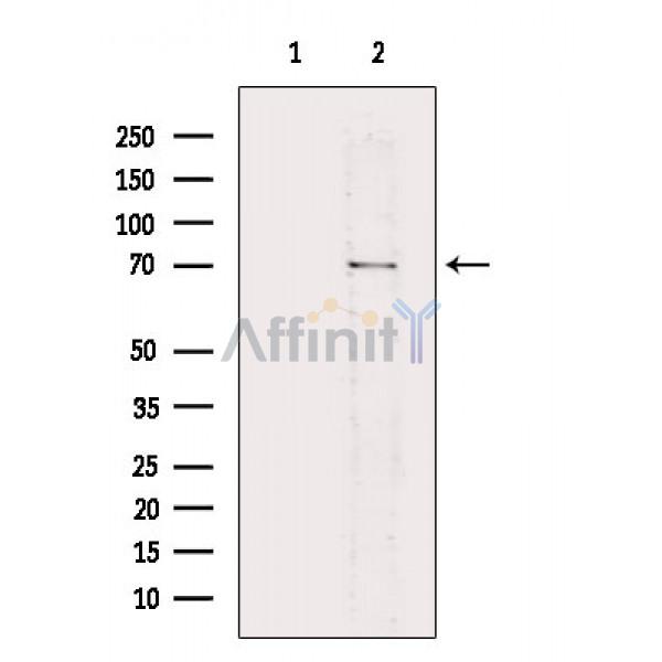 Plastin L Antibody - Western blot analysis of extracts from RAW264.