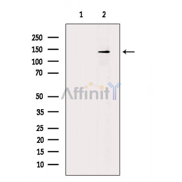 VE-cadherin Antibody - Western blot analysis of extracts from K562 cells(LPS 4h treatment), using VE-cadherin Antibody.