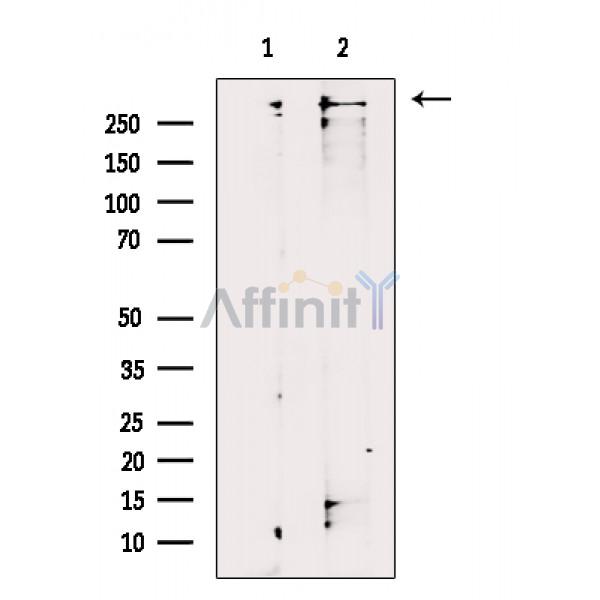 TRIO Antibody - Western blot analysis of extracts from Mouse brain, using TRIO Antibody.