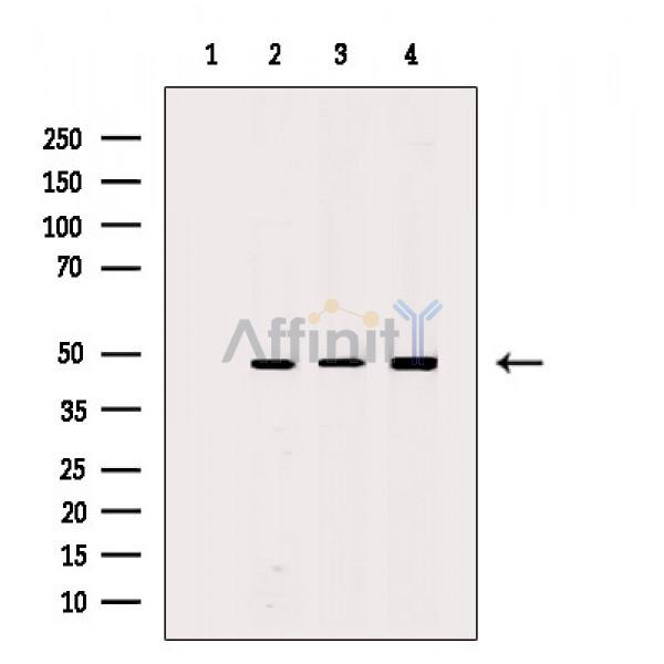 hnRNP F Antibody - Western blot analysis of extracts from various samples, using hnRNP F Antibody.