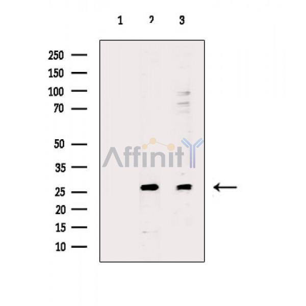 BCA3 Antibody - Western blot analysis of extracts from various samples, using BCA3 Antibody.