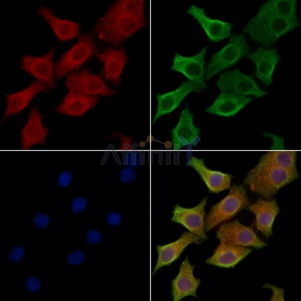 Cytokeratin 20 Antibody - AF0193 staining HepG2 cells by IF/ICC.